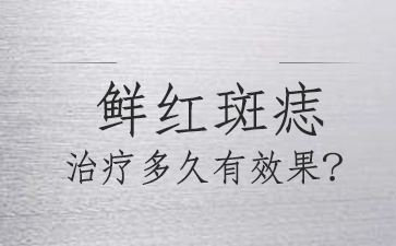 广州去胎记哪个医院好-鲜红斑痣可以根治吗?